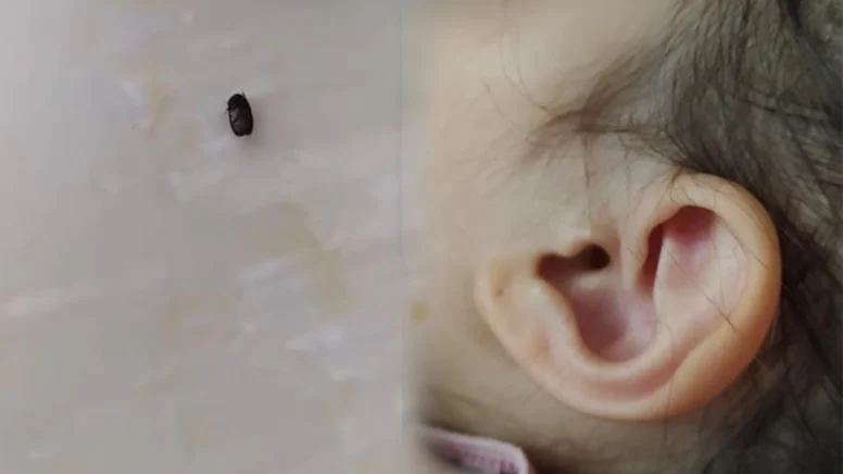 3 yaşındaki çocuğun kulağına kene yapıştı! Mahalleli tedirgin